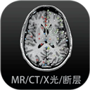 mx播放器